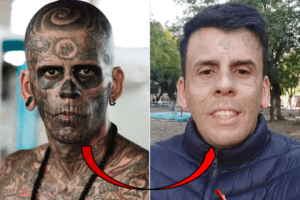 چهره جدید مردی که ۹۵ درصد بدنش خالکوبی شده بود