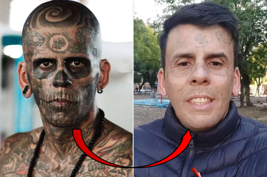 چهره جدید مردی که ۹۵ درصد بدنش خالکوبی شده بود