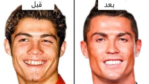 تغییرات چهره کریستیانو رونالدو از زمان پیوستن به منچستر زیر ذره‌بین یک جراح زیبایی