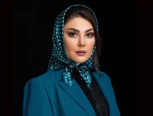 تغییر چهره لاله اسکندری بعد از عمل زیبایی مورد توجه قرار گرفت