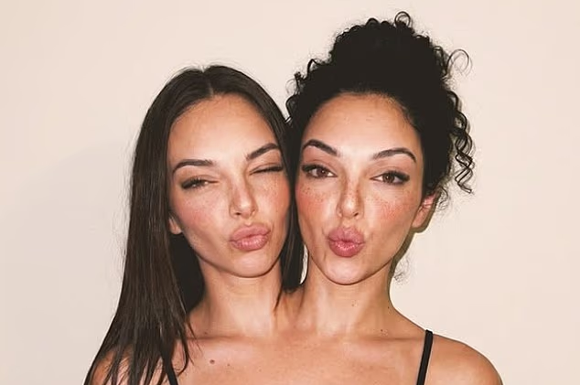 جنجال دوقلوهای به‌هم‌چسبیده مشهور در اینستاگرام فیک بود